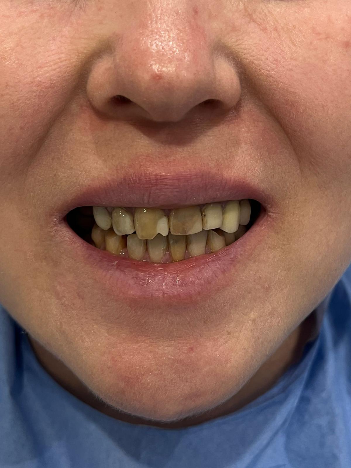 ECE Dental Patient Transformation